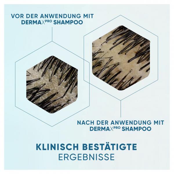 Head & Shoulders Anti-Schuppen Shampoo Derma X Pro Beruhigend